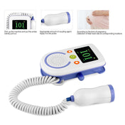A100D  Digital Fetal Doppler Ultrasound Sound Baby Heartbeat Detector Monitor Rechargeable Prenatal Pocket Fetal Doppler Stethoscope Eurekaonline